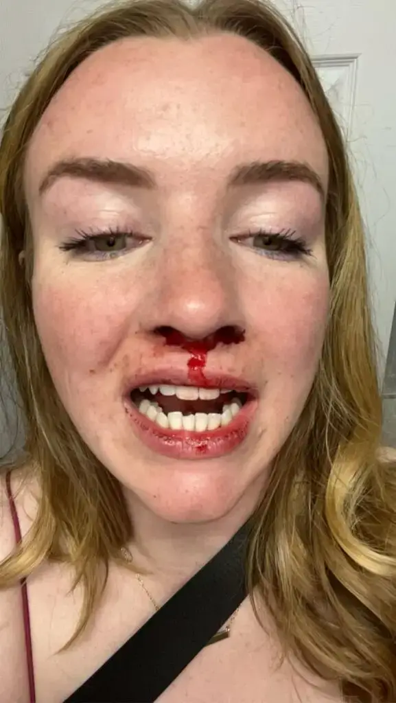 Lesbian Couple Beaten By Group Of Men During Birthday Celebration