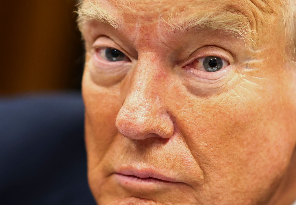 Trump Appears To Forget Word For “Alzheimer’s” – His Niece, Mary Trump, Suggests He May Have It