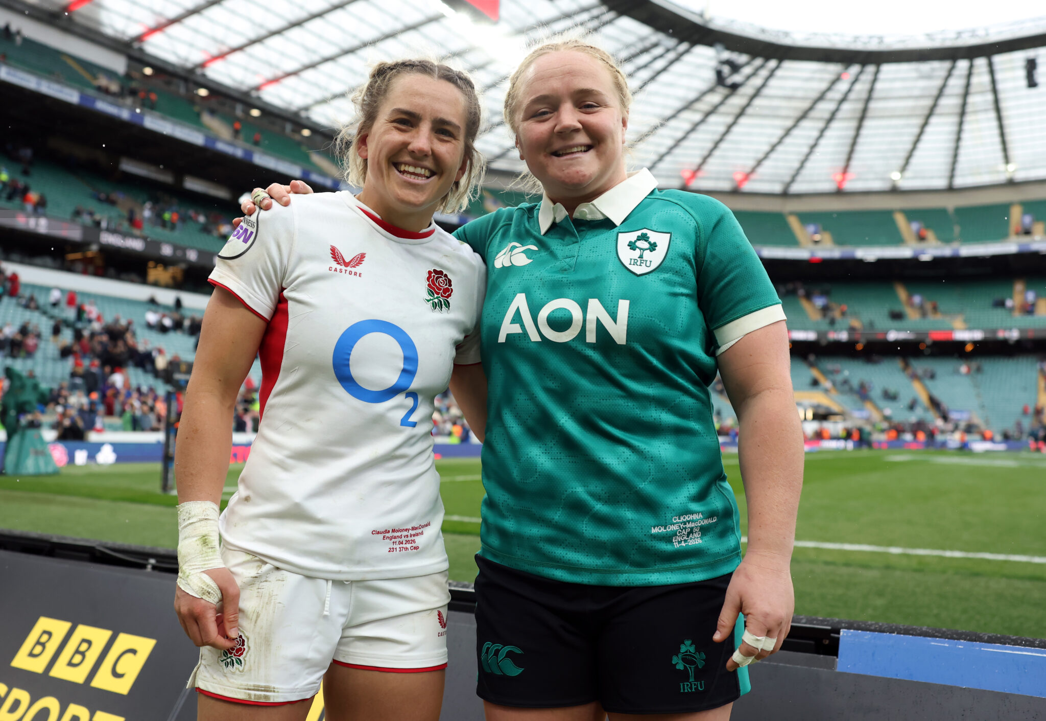 Love Wins On The Field: Rugby Wives Share Kiss After Six Nations ...